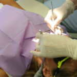 patient undergoing a tooth extraction at the dentist