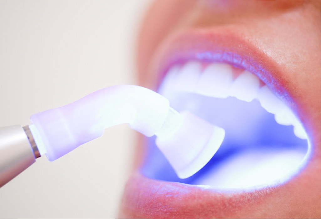 dental patient getting an oral cancer screening 