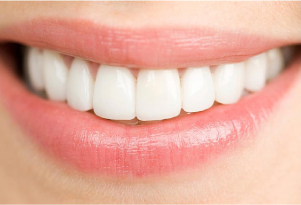 close up of a woman's smile showing off dental veneers