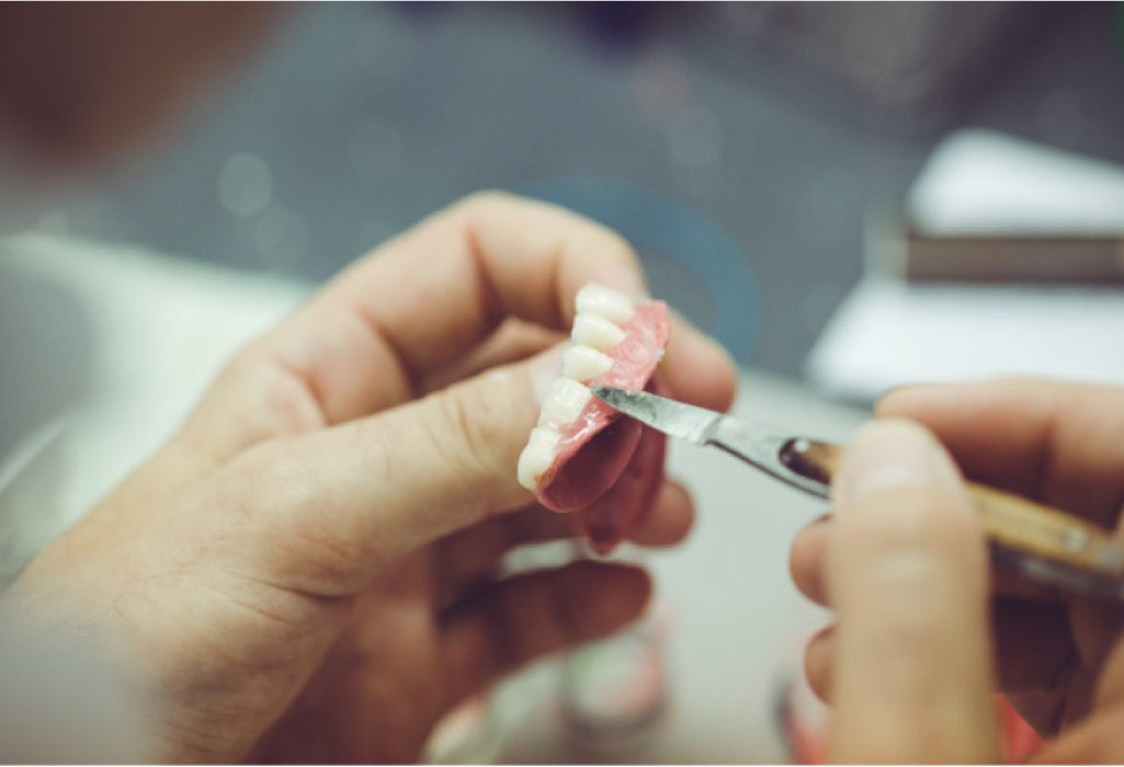 dentures being customized to fit over implants