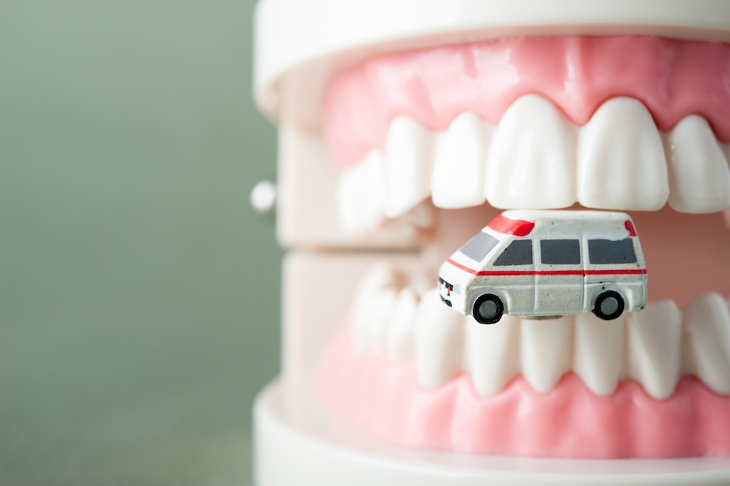 dental emergency, emergency dentist in San Antonio, loose dental crown, loose crown, dentist in San Antonio